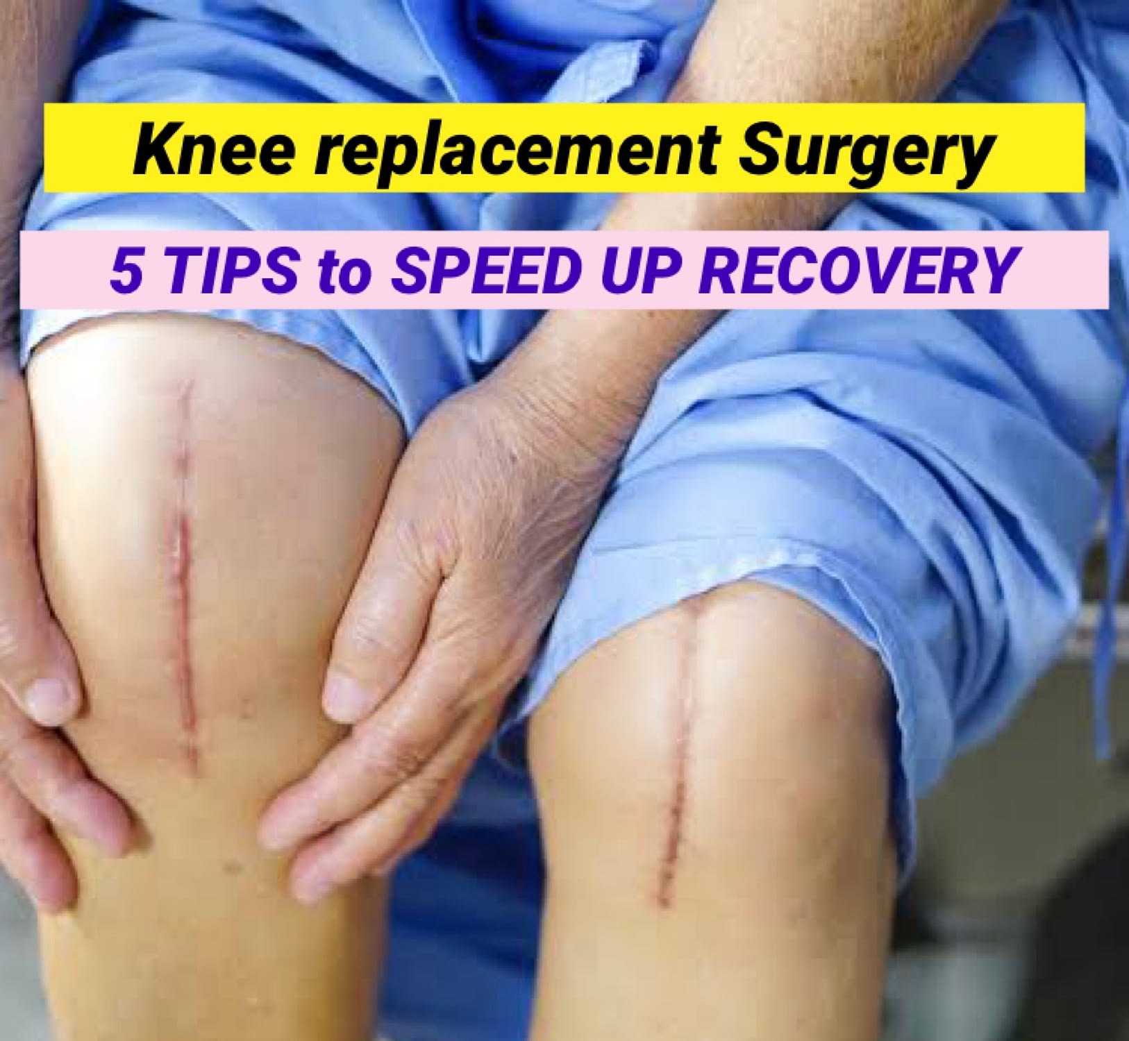 how-long-does-pain-and-stiffness-last-after-knee-replacement