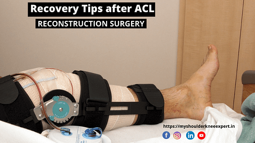 ACL-Reconstruction-surgery