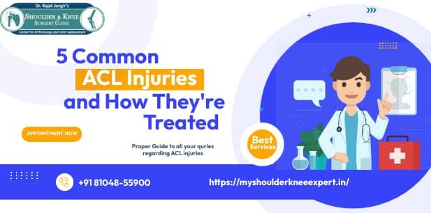 5 Common ACL Injuries and How They’re Treated