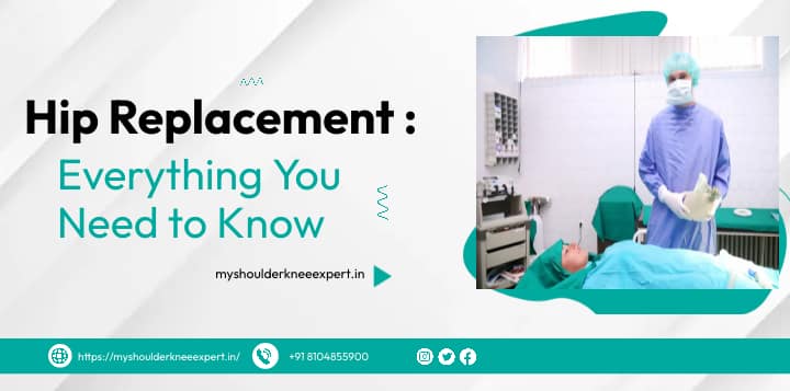 Hip Replacement: Everything You Need to Know