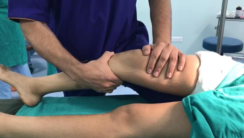 ACL TEAR RECONSTRUCTION SURGERY