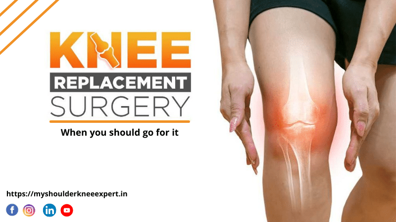 Knee Replacement-                                     When You Should Go For It