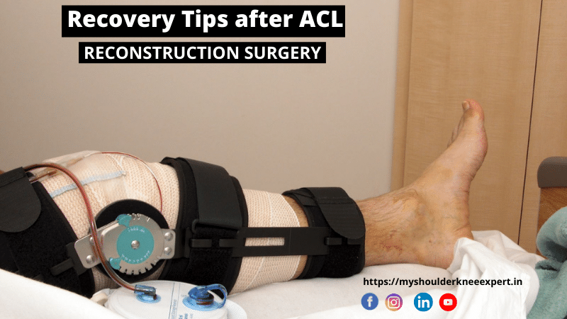 Recovery Tips after ACL RECONSTRUCTION SURGERY