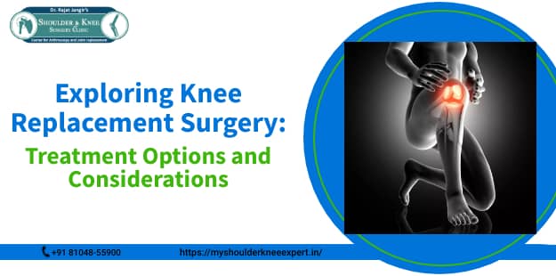 Exploring Knee Replacement Surgery: Treatment & Considerations